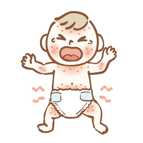 How to prevent diaper rash?